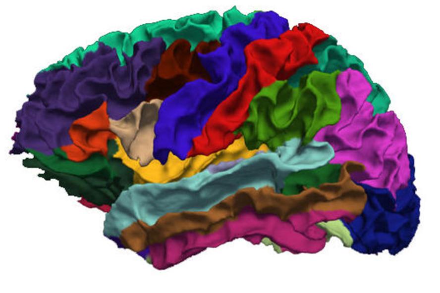 Visual of a brain design with multi-colors