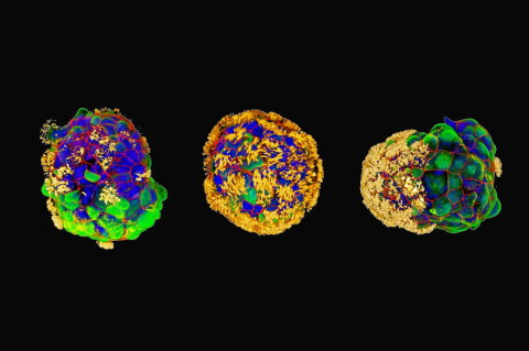 Three roundish objects made up of many colors, with short hair-like projections in yellow. Tiny biological multicellular bots called Anthrobots move around and help heal “wounds” created in cultured neurons